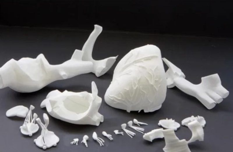 Лазерная печать костей: ученые нашли замену металлическим имплантам